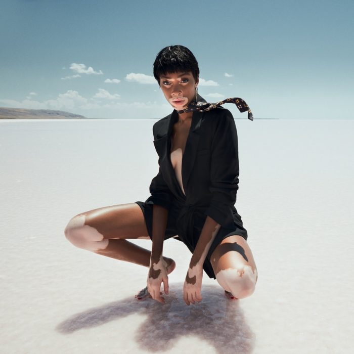 Winnie Harlow for ELLE Turkey July 2018 by Emre Guven